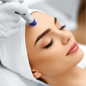 Microdermabrasion Patient Leaflet